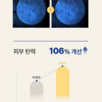 LBB 엘비비 골드렐라 펩타이드28 안티 멜라닌 케어세트 에센스150ml 크림100ml, 기미 잡티 관리가 고민일 때 본 후기 상품 이미지 1