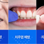화이니카 치탄플러스 잇몸 후기, 효능이 궁금한데 가격만큼 만족할까? 상품 이미지 3
