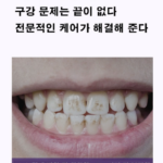 퍼플이 치아 코렉트 후기, 성분부터 사용법까지 제대로 알고 써볼까? 상품 이미지 3